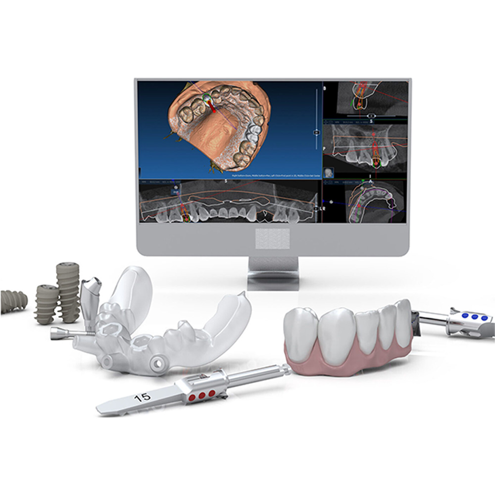 3D vizualizace navigované implantologie